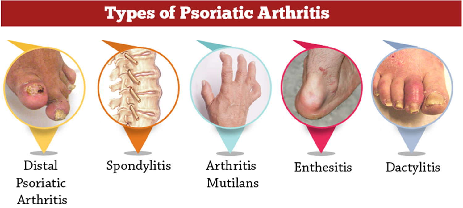 Tamaralaudesign Psoriatic Arthritis Diet Blog