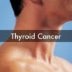 thyroid cancer