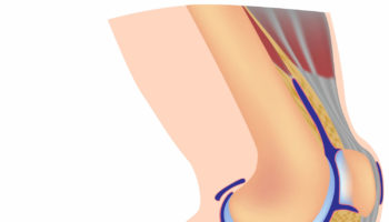 Baker’s cyst