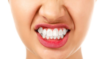 Bruxism