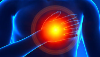 acute coronary syndrome