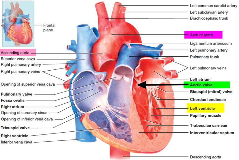 Aortic Valve Disease - Causes, Symptoms, Exercises And Treatment