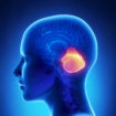 ataxia