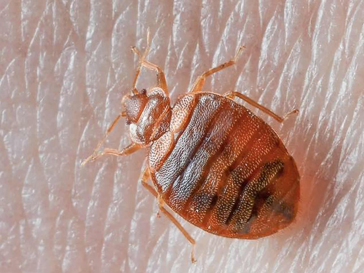 What Does Bed Bugs Look Like On Black Skin