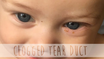 blocked tear duct