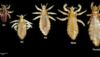 body lice