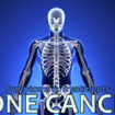 bone cancer