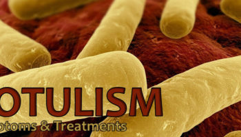 botulism