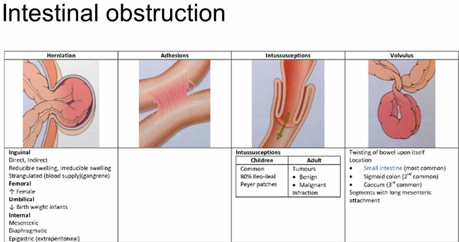 functional small bowel obstruction        <h3 class=