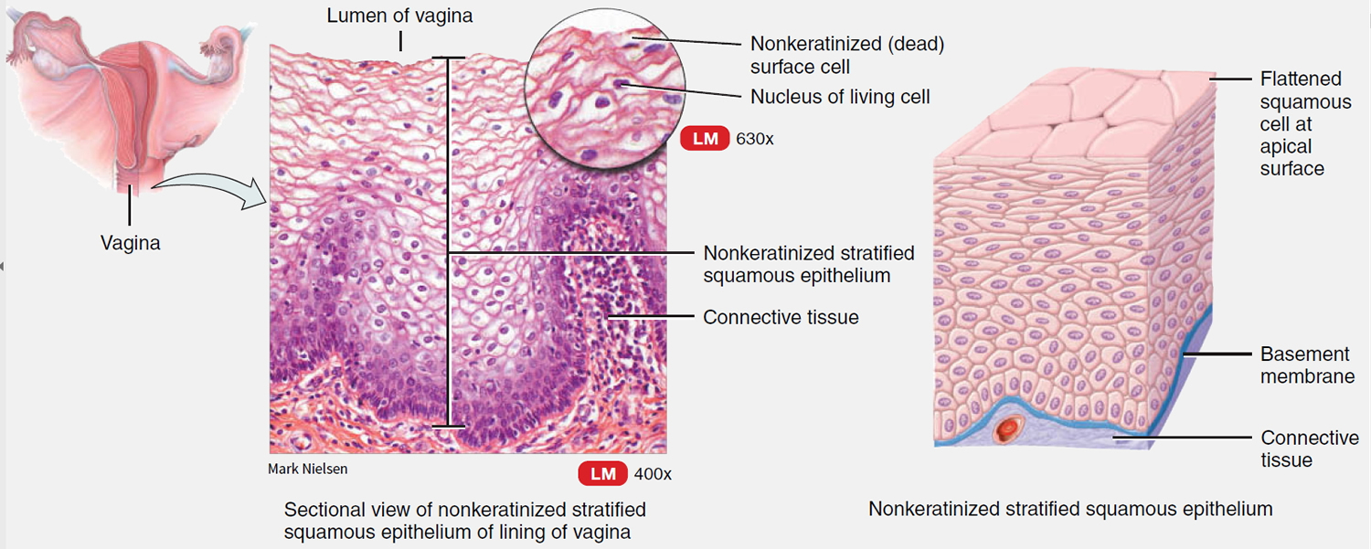 type of vagina shapes