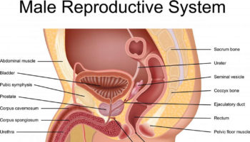 cryptorchidism