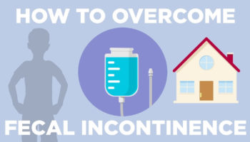 fecal incontinence