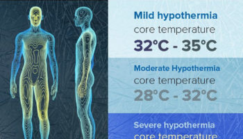 hypothermia