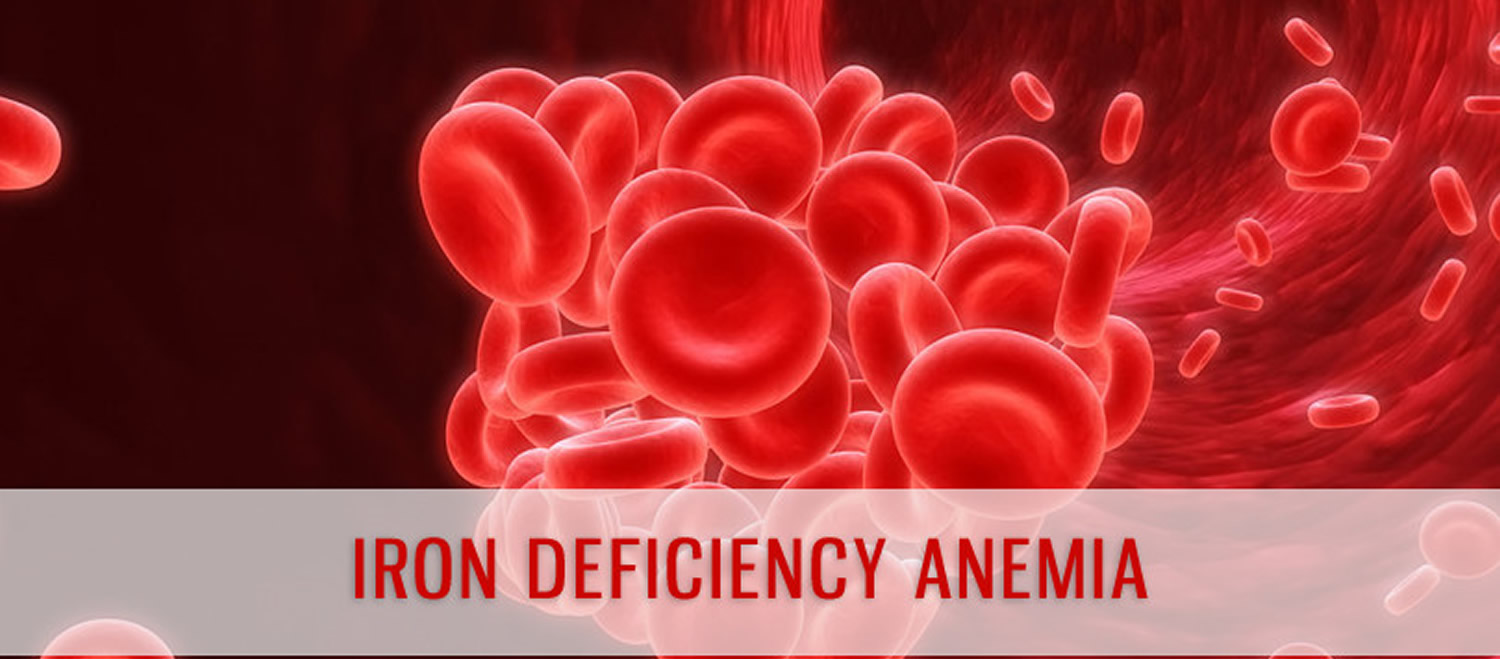 Iron Deficiency Anemia Causes Signs Symptoms Treatment 9773