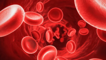 microcytic anemia