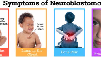 neuroblastoma