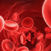 normocytic anemia