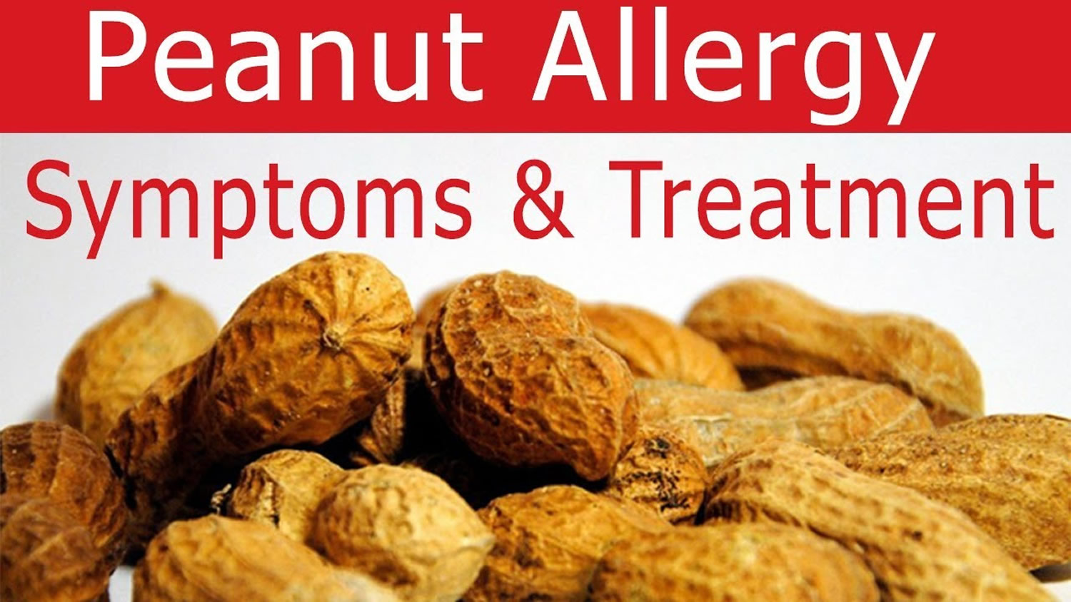 Peanut Allergy Causes, Reaction, Signs, Symptoms & Treatment