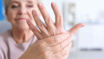 thumb arthritis