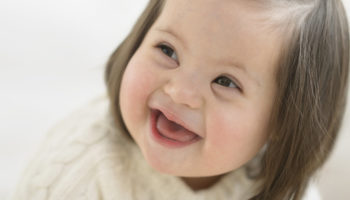 Down syndrome