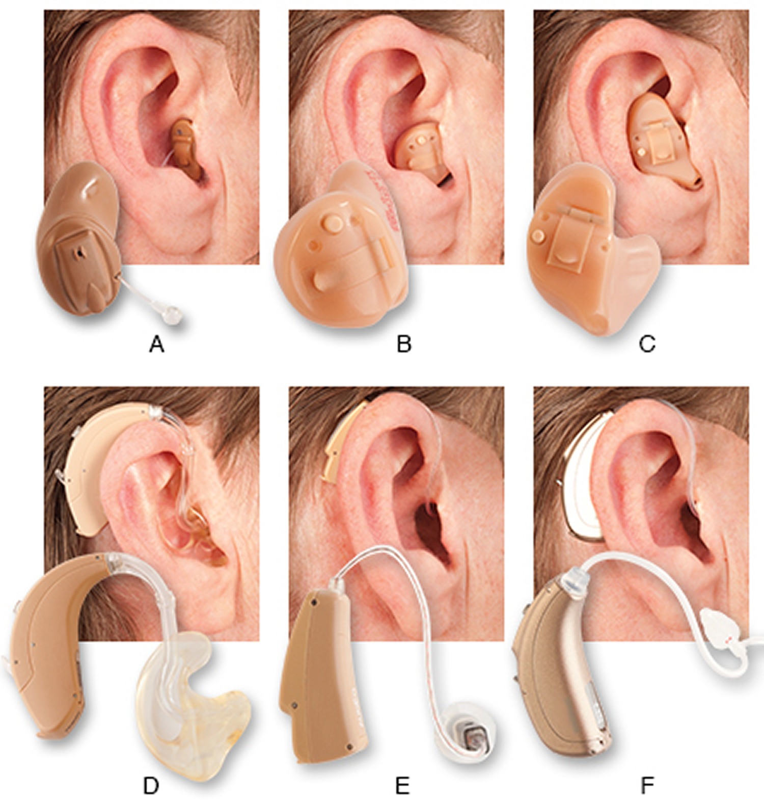 Hearing aid styles