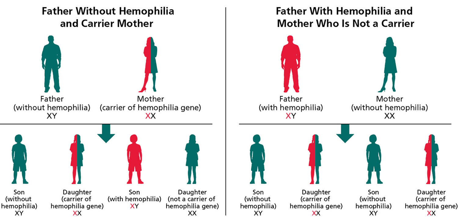 Hemophilia A inheritance pattern