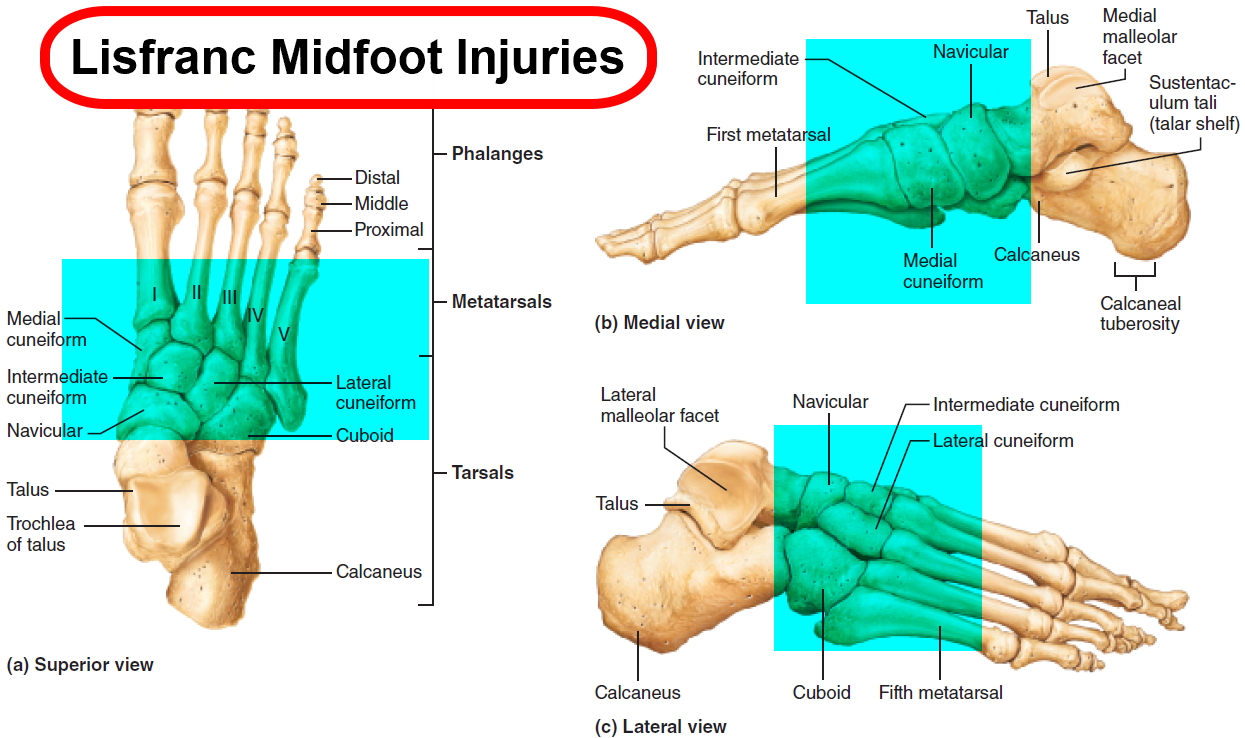 Lisfranc midfoot injury