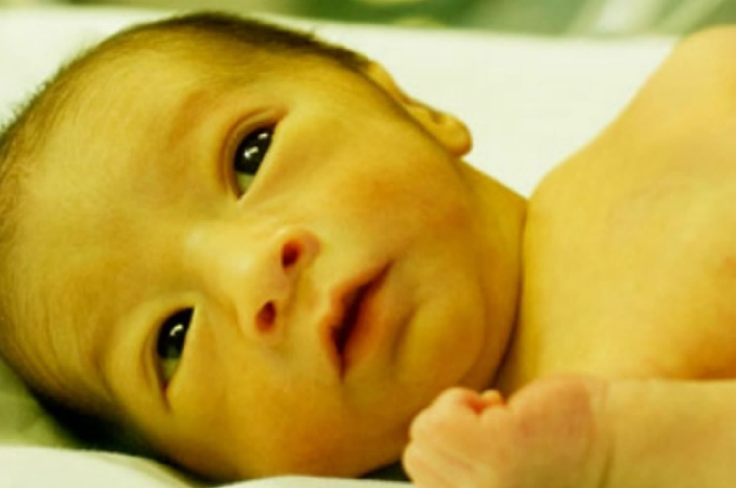 newborn jaundice