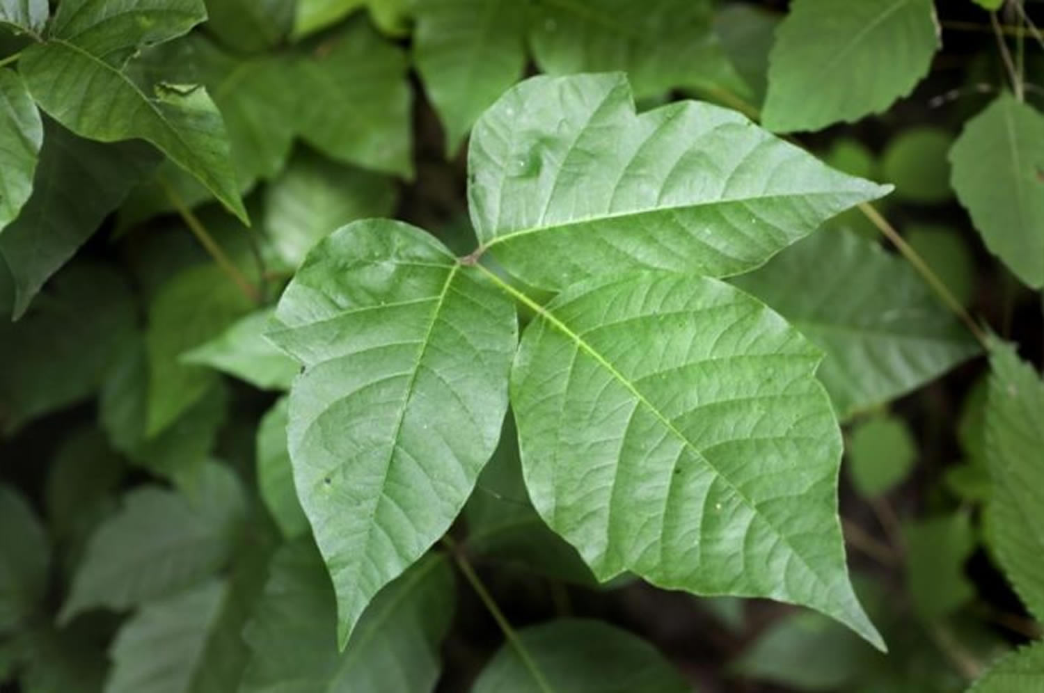 Poison Ivy Rash - Causes, How To Identify Poison Ivy Rash & Treatment