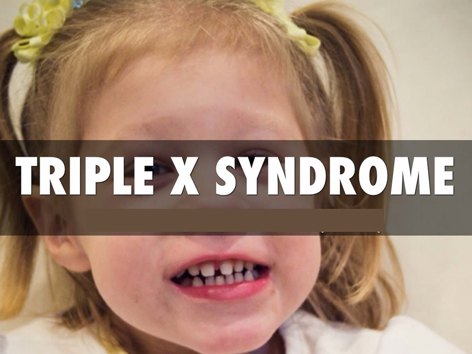 research on triple x syndrome