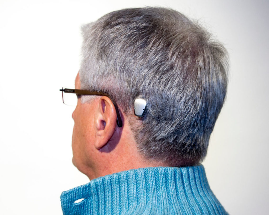 Hearing Loss Bilateral - Unilateral Hearing Loss - Causes & Treatment