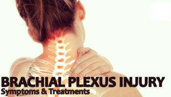 brachial plexus injury