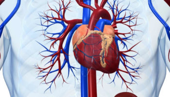 cardiogenic shock