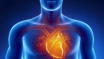 cardiomyopathy