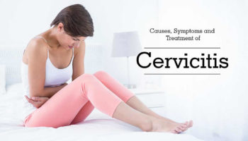 cervicitis