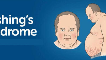 cushing syndrome