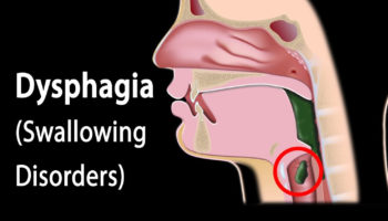 dysphagia