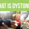 dystonia