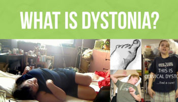 dystonia