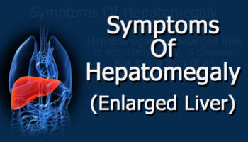 enlarged liver