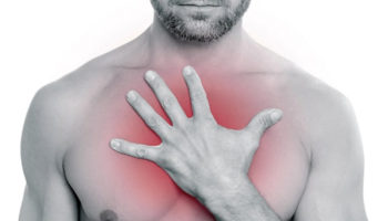 esophageal spasm