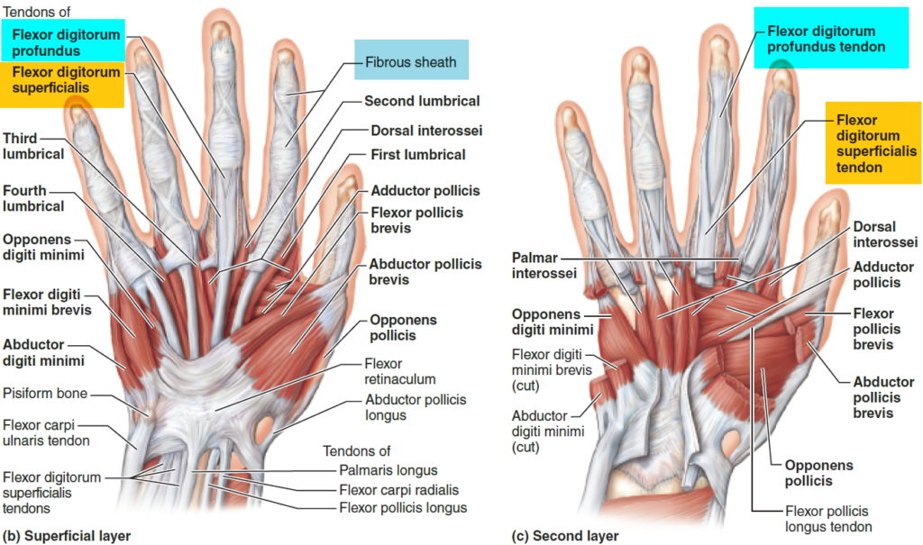 Trigger Finger - Causes, Symptoms, Splint, Exercises, Treatment