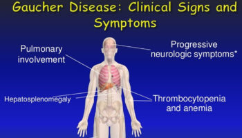 gaucher disease