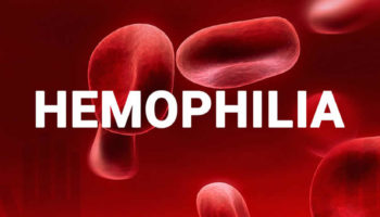 hemophilia