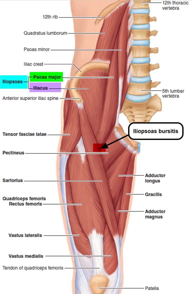 Bursitis Hip Trochanteric Knee Shoulder Elbow Causes Treatment