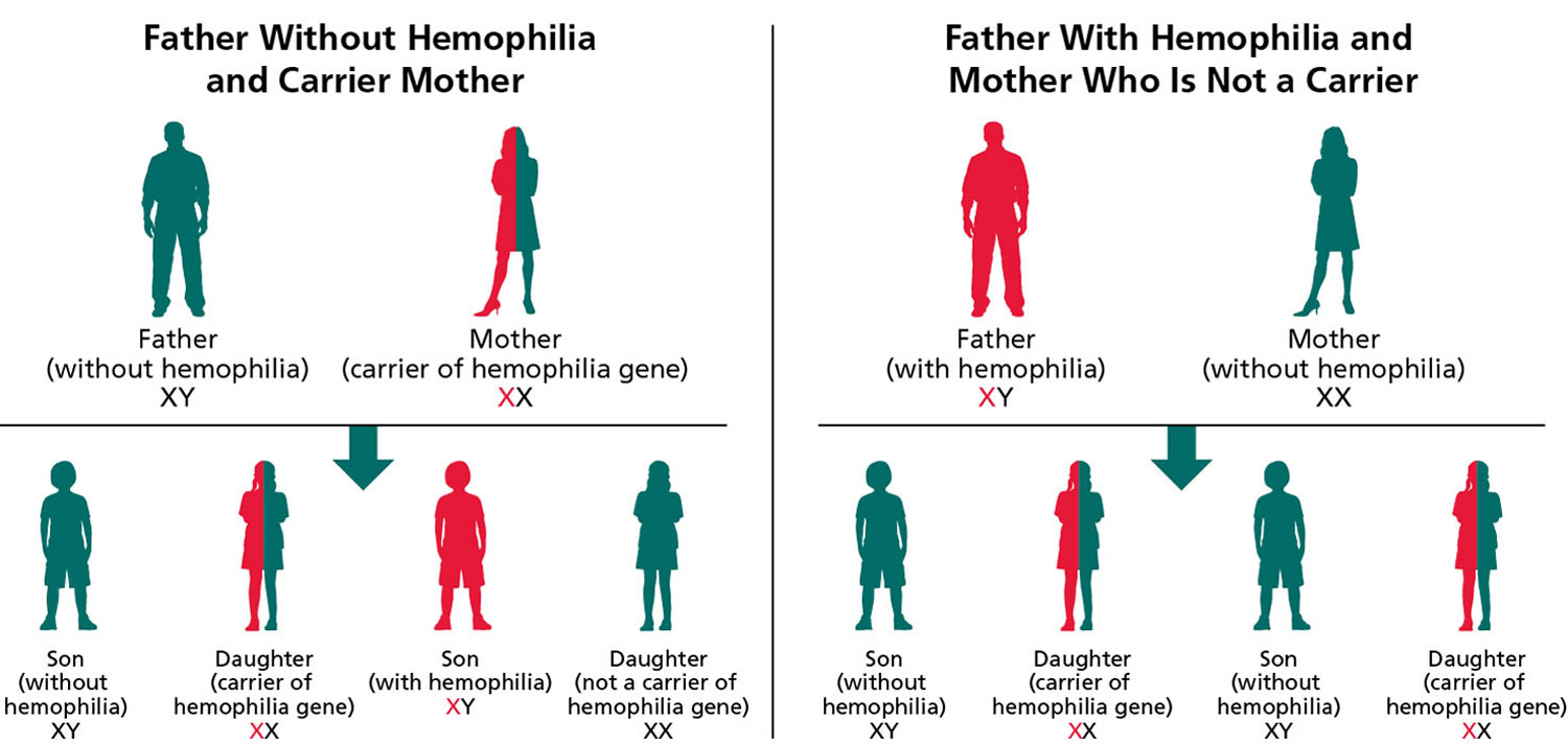 Hemophilia Causes Signs Symptoms Types Inheritance Treatment