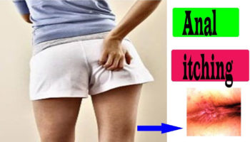 itchy anus