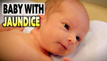 jaundice in newborns