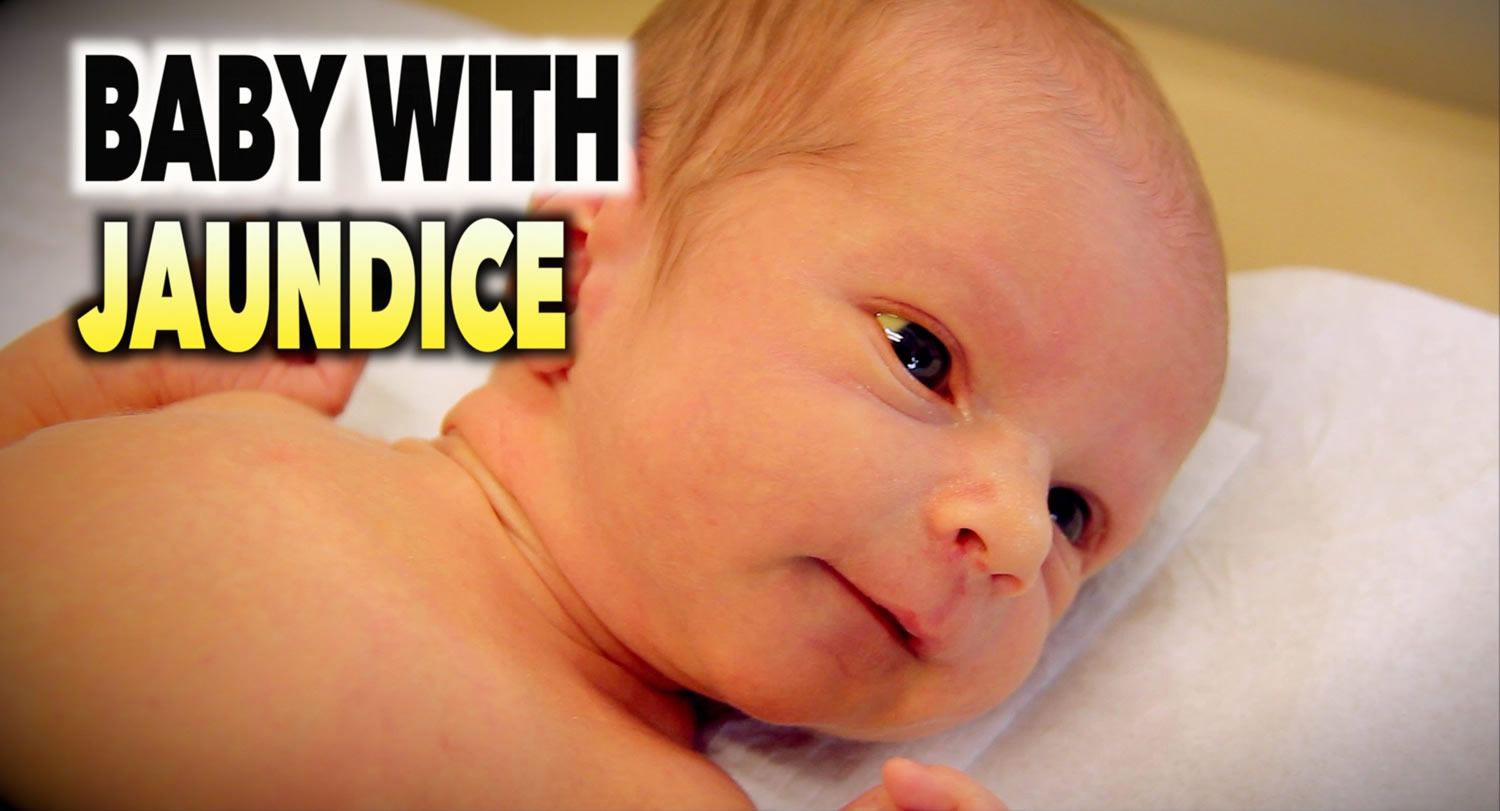 what causes jaundice