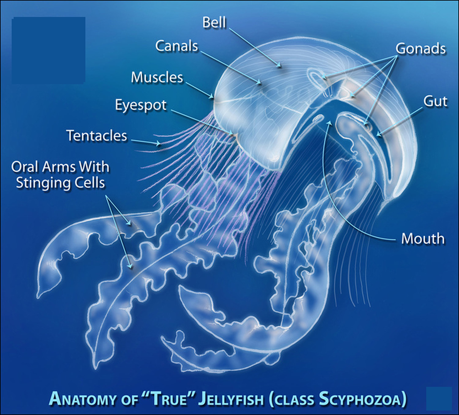 Jellyfish Sting - Symptoms, How To Treat A Jellyfish Sting
